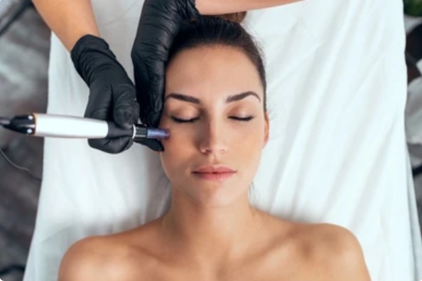 Dermabrasion Treatment