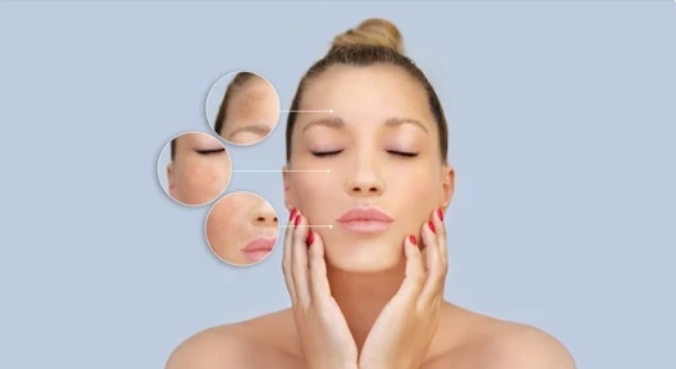 Dermabrasion Treatment