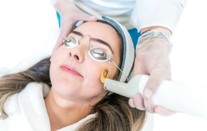 Dermabrasion Treatment
