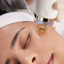 Microneedling Treatment